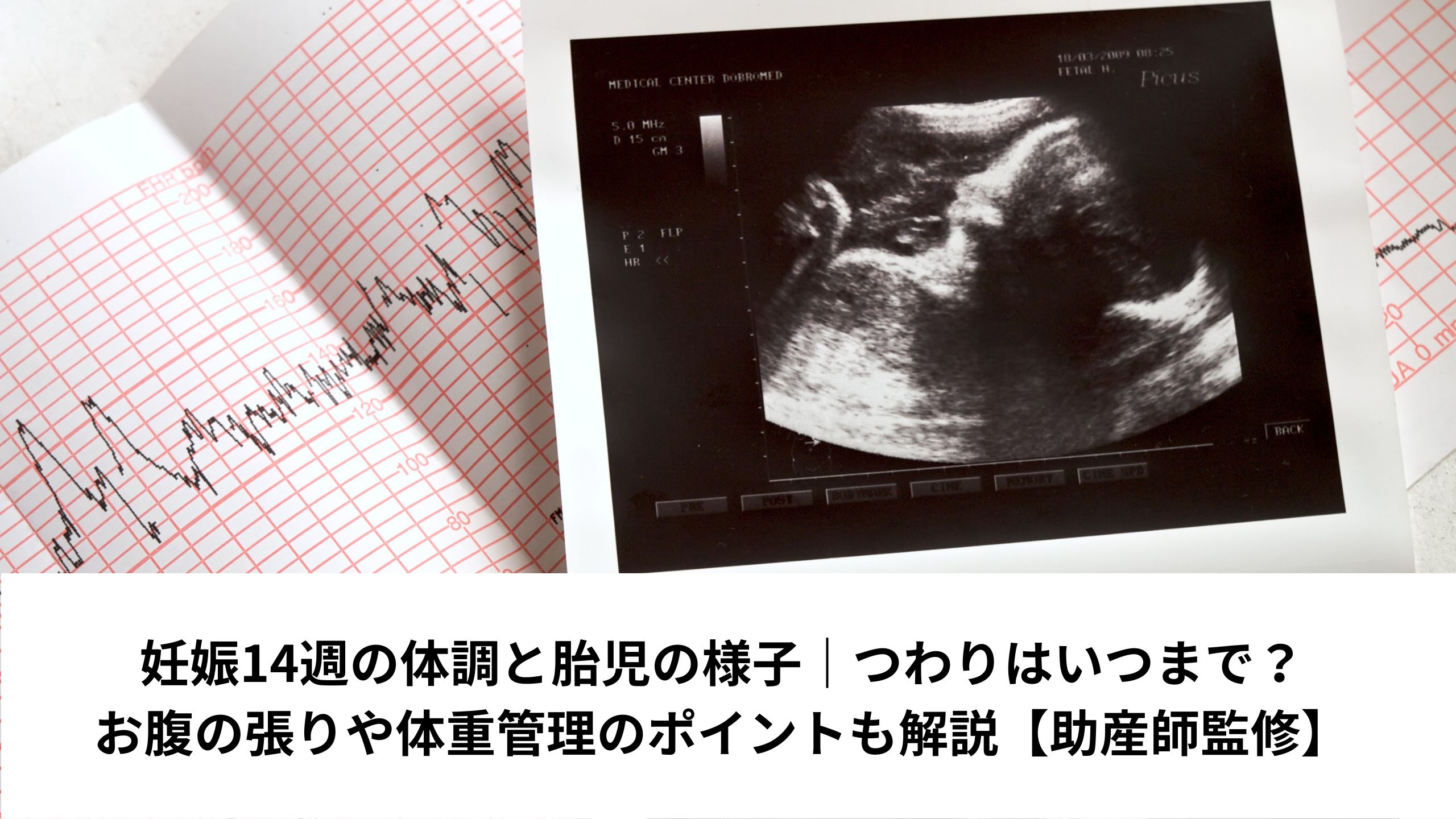 妊娠14週の体調と胎児の様子｜つわりはいつまで？お腹の張りや体重管理のポイントも解説【助産師監修】＊＊のアイキャッチ画像＊＊